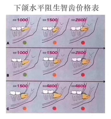 智齿保险比例解析